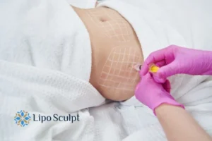 Do you want to know how long Aqualyx Wraysbury results last?