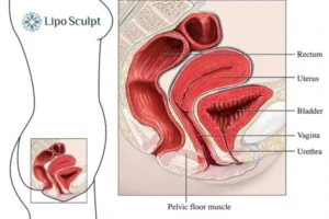 How EM Chair treatment Wraysbury can help Leaky bladder issues. Read more now!
